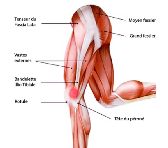 Bandelette ilio-tibiale et zone douloureuse à la face externe du genou