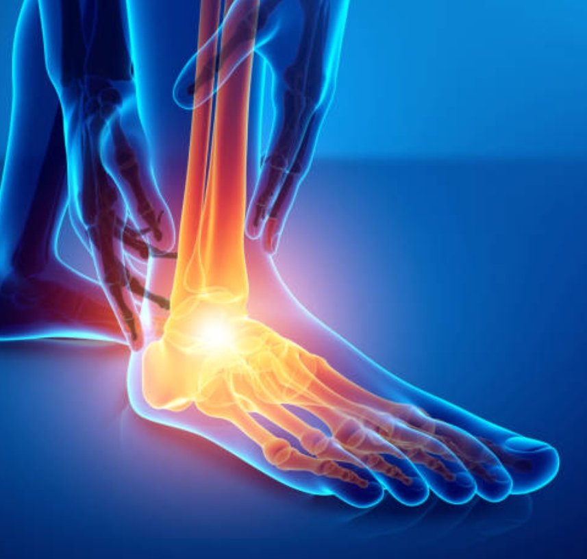 Chirurgie du pied